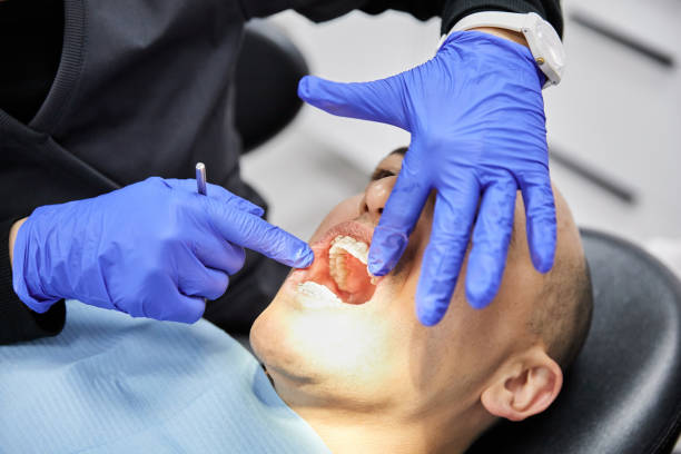 Best Emergency Dentist for Lost Fillings or Crowns in Northvale, NJ